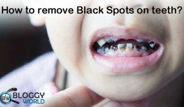 black staining on kid's teeth,teeth,teeth whitening,black teeth,black stains on teeth,how to avoid black stains on teeth,black stain on baby teeth,how to get rid of black stains on teeth,oral health - black teeth in kids,stain removal teeth,white teeth,how to whiten teeth,teeth talk girl,black stain removal teeth,baby teeth black stain,black teeth in kids,dentist cleaning teeth,teeth black stain removal at home,how to remove iron stain on baby's teeth, health,what nails tell about your health,the scariest stories on the internet,scariest story on the internet,healthy teeth,children's constipation,stay healthy,dentists reveal secrets about dentistry,scary stories from the internet creepypasta,infections in children,diseases in children,one of the most eye opening speeches,reveal the truth,what happens if we stop brushing teeth,secrets about apples,scary stories from the internet,secrets about dentist, black staining on kid's teeth,teeth,teeth whitening,black teeth,black stains on teeth,how to avoid black stains on teeth,black stain on baby teeth,how to get rid of black stains on teeth,oral health - black teeth in kids,stain removal teeth,white teeth,how to whiten teeth,teeth talk girl,black stain removal teeth,baby teeth black stain,black teeth in kids,dentist cleaning teeth,teeth black stain removal at home,how to remove iron stain on baby's teeth, cause of tooth discoloration,tooth discoloration,discolored front tooth,tooth,fractured tooth,treatment of tooth discoloration,dental trauma,how to block dark tooth,tooth resorption,how to stop tooth decay,how to practice as a dentist,how to fix a broken tooth,reverse tooth decay,treatment of single dark tooth,causes of tooth decay,nonvital tooth trearment,treatments for tooth decay,laser teeth whitening,tooth decay cure,single dark tooth,trauma, traumatic dental injuries,dental trauma guide,dental trauma in primary dentition,dental trauma splint,dental trauma guide pdf,dental trauma management,dental trauma guide permanent teeth,dental trauma treatment,dental traumatic injuries,dental trauma subluxation,dental trauma guidelines,dental trauma webinar,dental trauma surgery,flexible splint for dental trauma,dental trauma,dental trauma classification,dental traumatology, how to remove iron stain on baby's teeth,baby teeth stain removal,teeth,how to remove stain teeth,baby teeth,how to whiten teeth,how to avoid black stains on teeth,black stains on teeth due to iron supplements,remove iron stains baby teeth,iron stains on teeth,stain removal teeth,stains on teeth,how to clean baby teeth stain,how to brush baby's teeth,how to clean baby's teeth,teeth whitening,how to get white teeth,how to clean an iron,