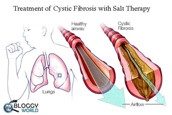 What is salt therapy,How it works,Rooms for salt therapy,Cost of salt therapy,Salt room las vegas frisco brieley hill boca raton,Best places for salt therapy (places for salt therapy usa pakistan Canada sauana etc ),Salt therapy at home ,Best solution for respiratory problem,salt therapy machine,salt lamp ,sea salt therapy.Himalayan salt therapy,Salt cave,Salt therapy spa,Himalayan salt cave,How to make salt rooms,Dry salt therapy,What are the types pf salt used in salt therapy,Fever,Sinusitis,Eczema,Allergies,Asthma,Cold and Flu,faqs,Salt cave near me,salt therapy center near me,halo therapy near me,do salt cave really work,salt cave spa,best salt cave spa,beast salt cave center,cheapest salt cave center,low price salt therapy center,what is a salt cave,healt boosting salt cave,best solution for all skin problems,Himalayan salt,sea salt,Wieliczka Salt Mine Health Resort,Bochnia Salt Mine Health Resort,best salt therapy center in Azerbaijan,Duzdag Physiotherapy Center, best salt therapy spa in Romania,Prahova Salt Mine,Salina Turda Salt Mine,Praid Salt Mine,Targu Ocna Salt Mine,best salt therapy spa in Ukraine, Salt Symphony,Tuzluca salt,Tuzluca Salt Therapy Center,salt cave,salt mine,speleotherapy,Famous salt therapy center in Azerbaijan,speleotherapy health centers in Poland,Eastern Europe,Salt Caves USA The Salt Cave & Wellness Spa of St. John,Indiana,Bethesda Salt Cave & Spa, Maryland.,Just Breathe,Salt Room, Massachusetts,The Salt Room, Nevada,The Salt Cavern, New Jersey,Montauk Salt Cave, New York,The Himalayan Salt Cave, Utah,salt lamp,halotherapy spa, salt therapy center,salt therapy centre,halotherapy machines,halo pocket uk, halo pocket usa,cure for everything is salt,salt water,salt for life,wonder solution, salt therapy,salt therapy room,salt therapy association,therapy,salt therapy home,salt therapy at home,salt therapy machine,in-home salt therapy,halogenerator salt therapy,salt therapy reviews,salt therapy session,salt therapy benefits,salt therapy for allergies,salitair salt therapy pipe,salt therapy salt pipe,dry salt therapy,salt therapy angie hilton,halogenerator salt therapy machine,what is salt therapy,benefits of salt therapy,salin plus review, himalayan salt inhaler,himalayan salt,salt inhaler,himalayan pink salt,pink himalayan salt,himalayan,himalayan salt benefits,inhaler,himalayan salt lamp,himalayan inhaler,pink himalayan salt inhaler,himalayan salt nasal inhaler,how to use himalayan salt inhaler,salt inhaler review,himalayan salt inhaler for asthma,himalayan salt inhaler directions,how to use salt inhaler,himalayan sea salt,natural solution himalayan pink salt nasal inhaler