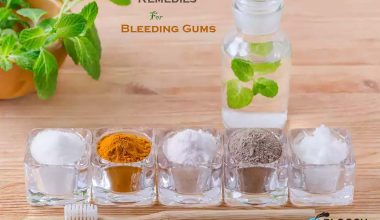 Bleeding gums treatment gel at home best home remedied for bleeding gums image presented by bloggy world