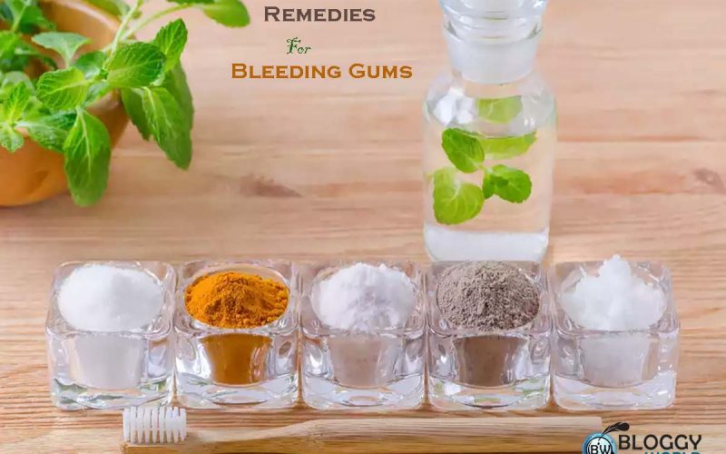 Bleeding gums treatment gel at home best home remedied for bleeding gums image presented by bloggy world
